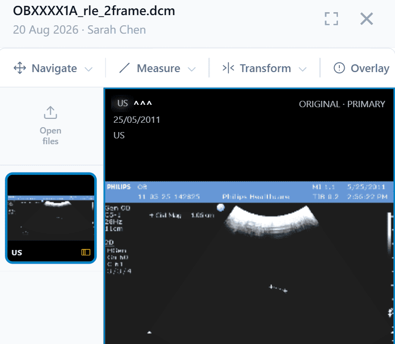 DICOM viewer showing an ultrasound scan with navigation and overlay tools