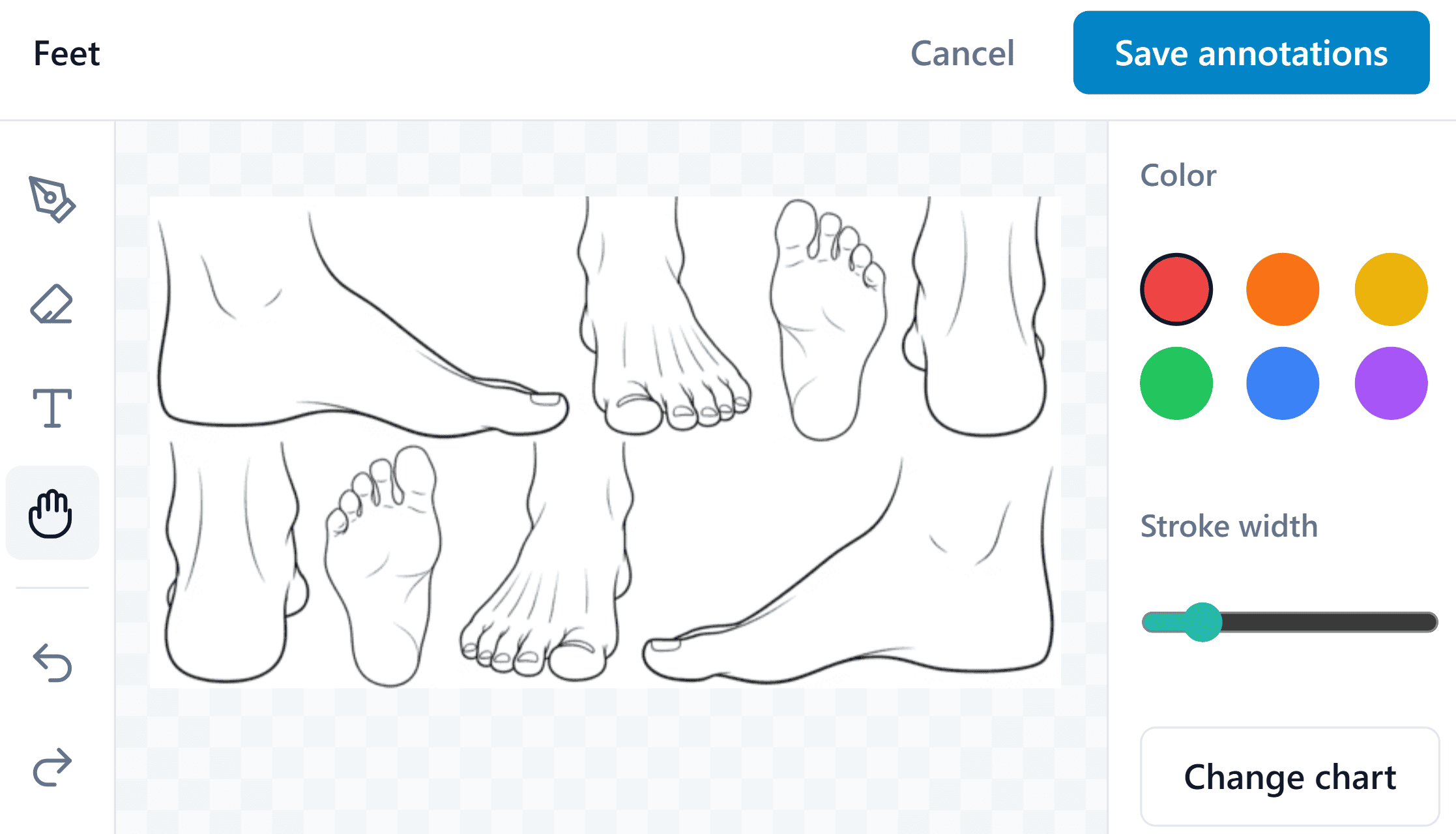 Body chart marking treatment locations