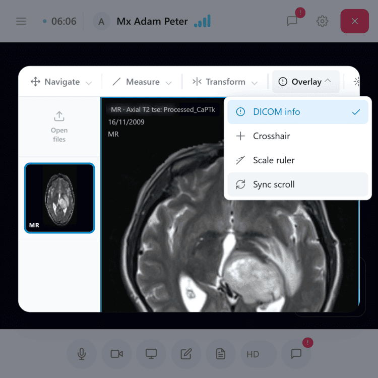 Telehealth video call with a DICOM scan shared and open in the same window as the consultation